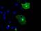 Neurotrophic Receptor Tyrosine Kinase 3 antibody, GTX83978, GeneTex, Immunofluorescence image 