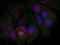 Myocyte Enhancer Factor 2A antibody, TA309952, Origene, Immunofluorescence image 