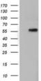 T-Complex 11 Like 2 antibody, NBP2-03100, Novus Biologicals, Western Blot image 