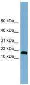 Ankyrin Repeat Domain 37 antibody, TA333406, Origene, Western Blot image 