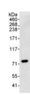 RNA Binding Motif Protein 14 antibody, ab70636, Abcam, Immunoprecipitation image 