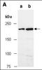 Tet Methylcytosine Dioxygenase 2 antibody, orb66693, Biorbyt, Western Blot image 