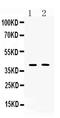 ISL LIM Homeobox 1 antibody, A02969-1, Boster Biological Technology, Western Blot image 