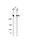 Filamin A antibody, abx035000, Abbexa, Western Blot image 