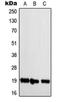 NBL1, DAN Family BMP Antagonist antibody, orb214292, Biorbyt, Western Blot image 