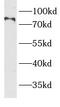 Bardet-Biedl Syndrome 10 antibody, FNab00814, FineTest, Western Blot image 