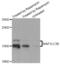 Microtubule Associated Protein 1 Light Chain 3 Beta antibody, abx003833, Abbexa, Western Blot image 