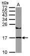 Ubiquitin Conjugating Enzyme E2 A antibody, GTX114186, GeneTex, Western Blot image 