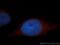 ArfGAP With Dual PH Domains 1 antibody, 13911-1-AP, Proteintech Group, Immunofluorescence image 