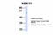 NIMA Related Kinase 11 antibody, A10929, Boster Biological Technology, Western Blot image 