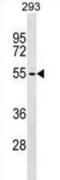 Zinc Finger And BTB Domain Containing 6 antibody, abx029744, Abbexa, Western Blot image 