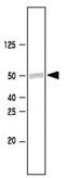 SET Domain Containing 7, Histone Lysine Methyltransferase antibody, ab14820, Abcam, Western Blot image 