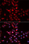 Cyclin Dependent Kinase Inhibitor 1B antibody, LS-C330905, Lifespan Biosciences, Immunofluorescence image 