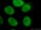 Poly(ADP-Ribose) Polymerase 1 antibody, 66520-1-Ig, Proteintech Group, Immunofluorescence image 