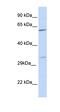 Phosphoribosyl Pyrophosphate Synthetase 2 antibody, orb330181, Biorbyt, Western Blot image 