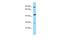 Ras Association Domain Family Member 9 antibody, A14106, Boster Biological Technology, Western Blot image 