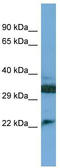 Complement C8 Gamma Chain antibody, TA346208, Origene, Western Blot image 