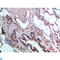 Achaete-Scute Family BHLH Transcription Factor 1 antibody, LS-C814225, Lifespan Biosciences, Immunohistochemistry paraffin image 