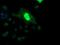 ETS Proto-Oncogene 2, Transcription Factor antibody, MA5-26125, Invitrogen Antibodies, Immunocytochemistry image 