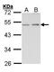 Endothelin B receptor antibody, PA5-34636, Invitrogen Antibodies, Western Blot image 