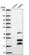 AE Binding Protein 2 antibody, PA5-54276, Invitrogen Antibodies, Western Blot image 