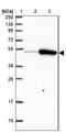 Thyroid Hormone Receptor Interactor 6 antibody, NBP2-33667, Novus Biologicals, Western Blot image 