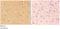 Abhydrolase Domain Containing 4 antibody, LS-C412088, Lifespan Biosciences, Immunohistochemistry paraffin image 