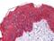 Keratin 5 antibody, MA5-15348, Invitrogen Antibodies, Immunohistochemistry paraffin image 
