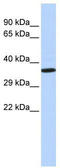 NK2 Homeobox 2 antibody, TA335820, Origene, Western Blot image 