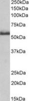 TNF Receptor Superfamily Member 1B antibody, MBS422890, MyBioSource, Western Blot image 