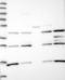Ubl carboxyl-terminal hydrolase 18 antibody, NBP1-92566, Novus Biologicals, Western Blot image 