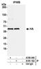 HA tag antibody, A191-102, Bethyl Labs, Immunoprecipitation image 