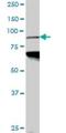 Lysine Acetyltransferase 2B antibody, H00008850-M05, Novus Biologicals, Western Blot image 