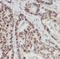 Heterogeneous Nuclear Ribonucleoprotein F antibody, FNab03952, FineTest, Immunohistochemistry paraffin image 