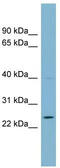 ZBED6 C-Terminal Like antibody, TA340289, Origene, Western Blot image 