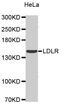 Low Density Lipoprotein Receptor antibody, MBS128829, MyBioSource, Western Blot image 