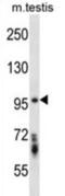 Serine/Threonine Kinase 10 antibody, abx028195, Abbexa, Western Blot image 