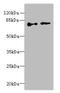 Ecdysoneless Cell Cycle Regulator antibody, A58886-100, Epigentek, Western Blot image 