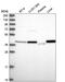 PSA antibody, PA5-65345, Invitrogen Antibodies, Western Blot image 