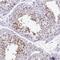 Cell Division Cycle 20 antibody, PA5-63103, Invitrogen Antibodies, Immunohistochemistry frozen image 