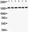 NPHS1 Adhesion Molecule, Nephrin antibody, PB9113, Boster Biological Technology, Western Blot image 