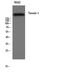 Tensin 1 antibody, A04990, Boster Biological Technology, Western Blot image 