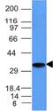 CD74 Molecule antibody, GTX34554, GeneTex, Western Blot image 