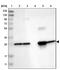 Ubiquitin C-Terminal Hydrolase L3 antibody, NBP1-86037, Novus Biologicals, Western Blot image 