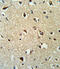 Rho GDP Dissociation Inhibitor Alpha antibody, abx031778, Abbexa, Western Blot image 