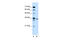 Solute Carrier Family 25 Member 32 antibody, 29-942, ProSci, Western Blot image 