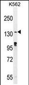 Ovostatin homolog 2 antibody, PA5-71560, Invitrogen Antibodies, Western Blot image 