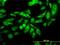 Kinesin Family Member C1 antibody, H00003833-M01, Novus Biologicals, Immunofluorescence image 