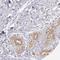 Inosine Monophosphate Dehydrogenase 2 antibody, NBP1-86177, Novus Biologicals, Immunohistochemistry frozen image 