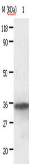 Annexin A2 antibody, CSB-PA081479, Cusabio, Western Blot image 